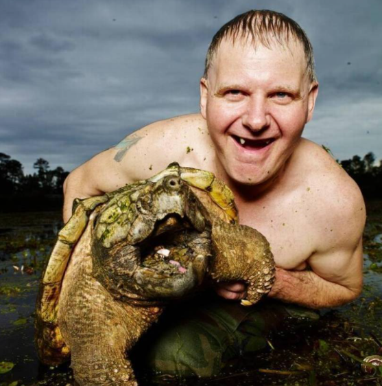 TURTLEMAN: WHAT HAPPENED TO HIM? HEART ATTACK RUMOURS DEBUNKED