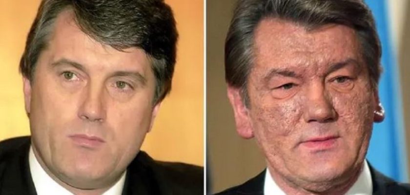 Viktor Yushchenko Face Before And After, Former President Was Poisoned By An Agent