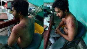 Assam Doctor Hojai Assault