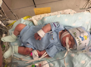 Hunter Bryant has had health complications since birth
