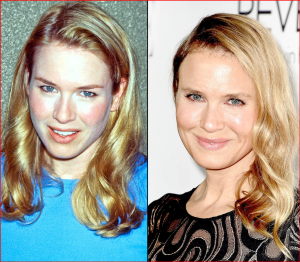 Photos of Renee Zellweger from 2011 and 2014 are compared.